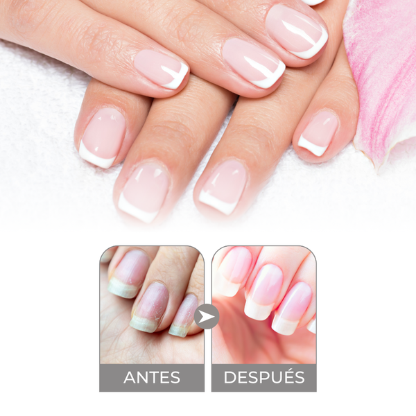 Base Efecto Relleno para Uñas Estriadas